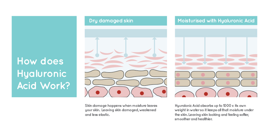 How hyaluronic acid works. 
